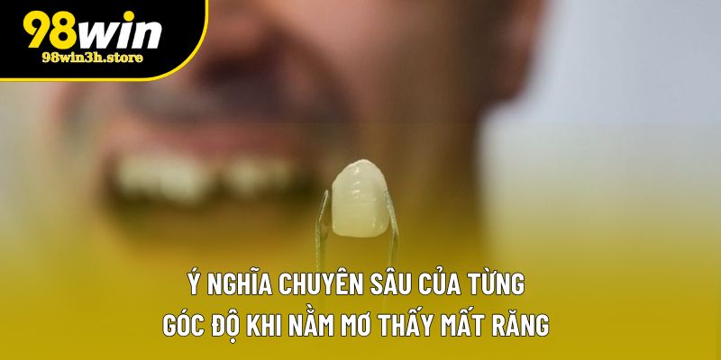 Ý nghĩa chuyên sâu của từng góc độ khi nằm mơ thấy mất răng Ý nghĩa chuyên sâu của từng góc độ khi nằm mơ thấy mất răng